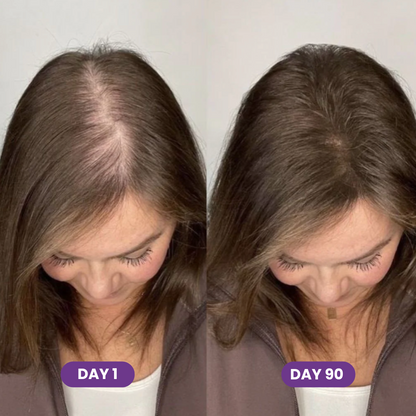 Hair Growth Accelerator Capsules & Soft Chews